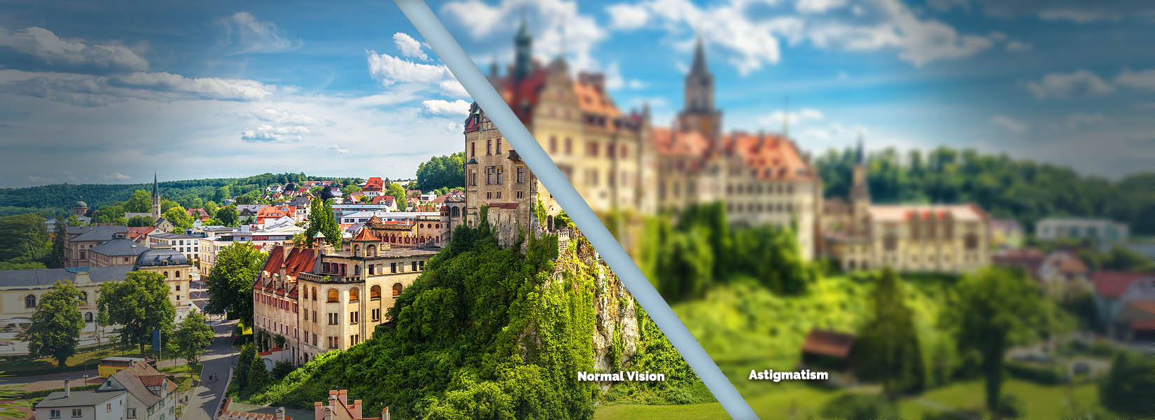 Astigmatism Treatment in Cumberland