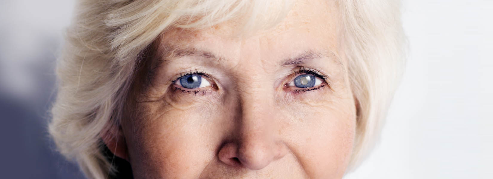 Cataract Surgery in Cumberland